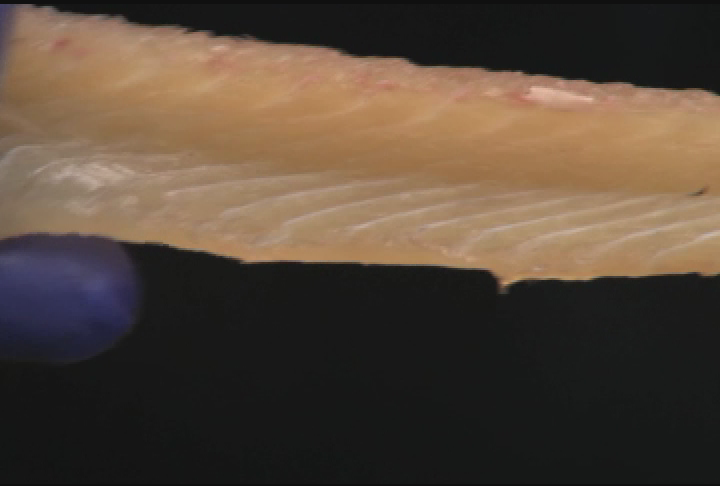 Removing Y Bones from Northern Pike